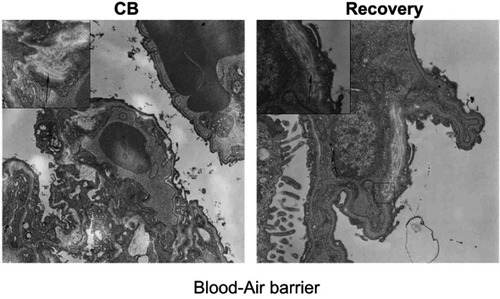 Figure S5 Representative TEM images of blood-gas barrier in rats (6000×).Notes: A higher magnification of the lung tissue (12000×). The arrows indicate fibrosis of blood-gas barrier.