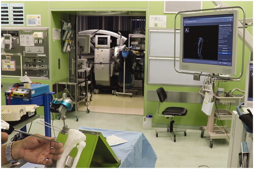 Figure 6. Rehearsal of the navigation system using a patient tibia model.