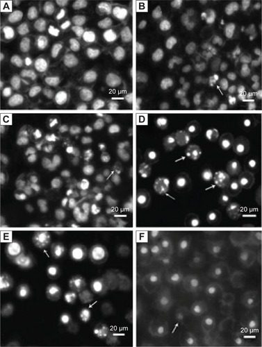 Figure 4 Morphology detection of HepG2 cells treated with different concentrations of OA-MVLs.Notes: (A) Control group. (B) Cells treated with OA-MVLs (20 μmol/L). (C) Cells treated with OA-MVLs (80 μmol/L). (D) Cells treated with OA-MVLs (160 μmol/L). (E) Cells treated with OA-MVLs (240 μmol/L). (F) Cells treated with OA-MVLs (290 μmol/L). The arrows indicate the damaged cells. Magnification =200×.Abbreviation: OA-MVLs, oleanolic acid-encapsulated multivesicular liposomes.