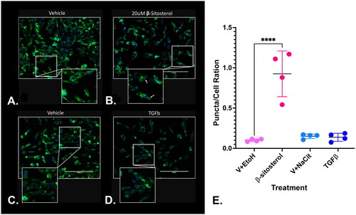 Figure 5. Beta-sitosterol treatment is associated with collagen sequestration in N1 cells. N1 cells treated with vehicle + ethanol, 20 μM beta-sitosterol, vehicle + sodium citrate or 4 ng/ml TGFβ were subjected to immunofluorescence for collagen 1. Collagen 1 distribution appeared similar between ethanol vehicle-, sodium citrate vehicle-, and TGFβ-treated cells but beta-sitosterol treated cells demonstrated a high number of internal fluorescently stained collagen protein in a ‘punctate’ type pattern (A). the puncta/cell ratio was significantly (p < .001) higher in beta-sitosterol treated than other treated cells (B). puncta were counted in cells treated with ethanol vehicle (N = 169), 20 µM beta-sitosterol (N = 146), sodium citrate vehicle (N = 175) or TGFβ (N = 191). 14, 17, 16, and 22 puncta were identified and counted in ethanol vehicle-, 20 µM beta-sitosterol-, sodium citrate vehicle-, and TGFβ-treated cells, respectively.