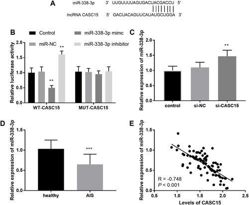 Figure 3 (A) The binding region between CASC15 and miR-338-3p. (B) The consequence of luciferase assay. (C) Silenced CASC15 increased the levels of miR-338-3p. (D) The levels of miR-338-3p were lessened in AIS patients. (E) The levels of miR-338-3p were inversely associated with CASC15. **P < 0.01, ***P < 0.001.