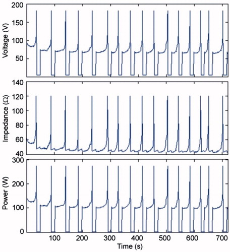Figure 2. Evolution of voltage, impedance and power during a 12-min RFA using pulses of 1500 mA in the in vivo case.