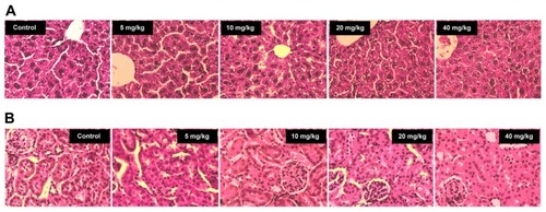 Figure 4 Liver and renal kidney slices (stained with hematoxylin and eosin). Row (A) presents pictures of Liver slices and Row (B) pictures of Kidney slices.