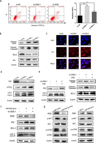 Figure 5. ZEB2 knockdown regulated apoptosis and autophagy in AML. WB and flow cytometry were carried out to detect the apoptosis of THP-1 cells (a and b). GFP-LC3 expression was detected by immunoﬂuorescence (c). The autophagy-associated proteins, p62, ATG12 and LC3, in THP-1 were detected by WB (d). Levels of autophagy-related and apoptosis-related proteins were determined by WB with or without 5 mM 3-MA added to ZEB2 knockdown cells (e). Modulation of ZEB2 partially reversed miR-454-3p-regulated cellular processes in THP-1 cells. Rescue assays of apoptosis and autophagy after co-transfection with miR-454-3p-inhibitor and sh-ZEB2, at the protein level (f). Transfection of THP-1 cells with miR-454-3p-inhibitor or mimic was examined by WB for levels of autophagy signaling pathway proteins (g). *p < 0.05, **p < 0.01, ***p < 0.001. n.s., not significant.