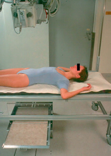 Figure 1:4A RSA in supine, baseline position. (Reproduced with permission from Spine).