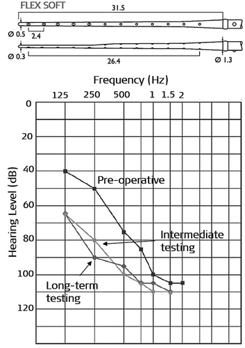 Figure 37. FLEXSOFT™ electrode array with its dimensions in millimetres (image courtesy of MED-EL). Mean pure-tone audiograms measured at three different time points [Citation31]. Statistical analysis: Nonparametric Wilcoxon signed-rank test to look for the difference between test intervals (p < .05). Reproduced by permission of Wolters Kluwer Health, Inc.