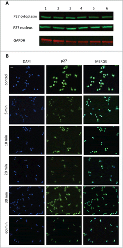 Figure 4. The effect of GHRH antagonist on the localization of p27 in A-375 human malignant melanoma cells determined by Western blot (A) and immunocytochemistry (B). The level of p27 was detected in cytoplasmic and nuclear fractions of A-375 cells with Western blot following incubation with 10 μM MIA-690 for 5, 10, 20, 30 and 60 min (A). Internal standard for the cytoplasmic fraction was GAPDH. Changes in the intracellular localization of p27 following incubation with 10 μM MIA-690 was also detected by immunocytochemistry. In this experiment GHRH antagonist was again added for 5, 10, 20, 30 and 60 min. Immunostained coverslip samples were imaged with a Nikon Eclipse Ti Inverted Microscope fitted with epifluorescence optics and images were recorded using a Nikon DS-Qi1Mc camera. Nuclei are labeled with DAPI (blue). Bars correspond to 100 μM.