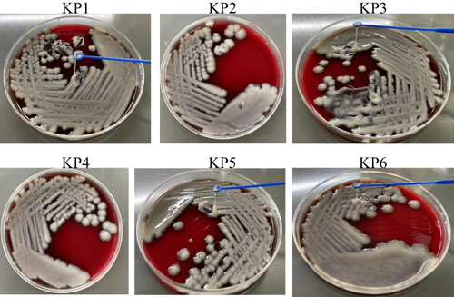 Figure 3 Images of hypermucoviscous phenotype assessed by string test.