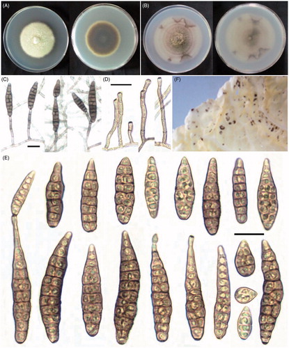 Figure 1. Morphology of Alternaria brassicifolii CNU 111118. (A) Colony on PDA; (B) colony on PCA; (C) sporulation pattern; (D) conidiophores; (E) conidia; (F) symptoms on the detached leaves of Brassica rapa L. subsp. pekinensis (Lour.) Hanelt. Bars = 20 μm.