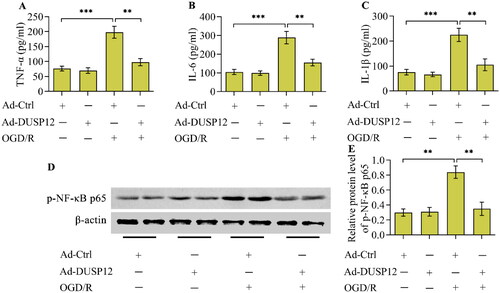 Figure 3. The effect of DUSP12 overexpression OGD/R-evoked inflammatory response. (A-C) Concentrations of TNF-α, IL-6 and IL-1β in Ad-Ctrl- or Ad-DUSP12-infected neurons with or without OGD/R were quantified by ELISA. (D, E) Levels of phosphorylated NF-κB p65 in Ad-Ctrl- or Ad-DUSP12-infected neurons with or without OGD/R were examined by Western blotting. n = 3. **p < 0.01, and ***p < 0.001. Statistical differences were determined using one-way ANOVA followed by Tukey’s post-hoc test.