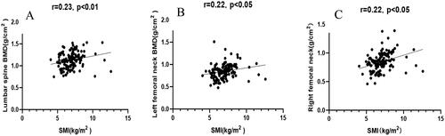 Figure 3. (A) Correlation between the SMI and the BMD of the lumbar spine. (B) Correlation between the SMI and the BMD of the left femoral neck. (C) Correlation between the SMI and the BMD of the right femoral neck.