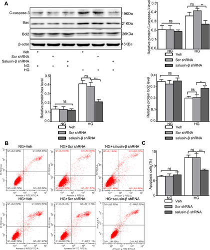 Figure 8 Salusin-β knockdown attenuated apoptosis in HG-treated HRECs. After adenovirus-mediated transduction of shRNA against salusin-β or scrambled shRNA for 24 h, HRECs were cultured in HG medium for 48 h. (A) The levels of apoptosis-associated proteins, including cleaved caspase-3, Bax, and Bcl2, were analysed by Western blotting. (B) Apoptosis rates were determined by flow cytometry. (C) Statistical analysis of the apoptosis rates was performed. One-way ANOVA with Tukey’s test was used to assess the differences among the groups. n=3. *p<0.05, **p<0.01, ***p<0.001.