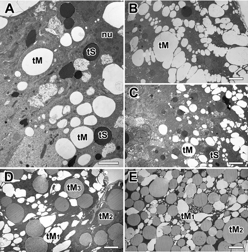 Figure 4. Electron micrographs of the major ampullate gland in A. cavaticus during pre-molt period. A: Glandular epithelium contains two types of secretory granules with varying sizes and densities. B, C: Electron lucent secretory granules accumulated at the basal region appear almost spherical vesicles. Large vesicles are formed by fusion with small vesicles from rER. (D,E) Type-M granules (tM) are composed of homogeneous internal materials with varying electron densities. Electron densities are changed from electron-lucent (tM1) to membranous (tM2), and finally fine fibrous appearance (tM3). nu: nucleus, tS: Type-S granule. Scale bar = 1 µm (A) and 0.5 µm (B-E).