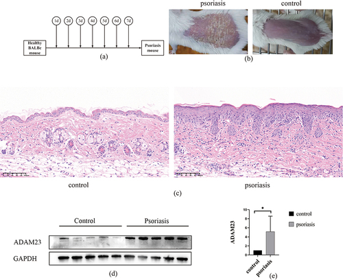 Figure 7 Upregulation of ADAM23 in mice psoriasis tissues. (a and b) Establishment of a mouse model of psoriasis. (c) H&E staining of skin from healthy mice and skin lesions from psoriatic mice. (d and e) Protein levels of ADAM23 in mice psoriasis lesion samples assessed by Western blot analysis.