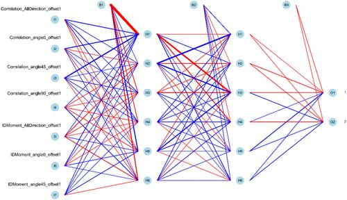 Figure 4 Predictive model visualization based on ANN algorithm. The candidate factors associated with myometrial invasion were ordered via the ANN algorithm. Red represents the positive weight, and blue represents the negative weight.