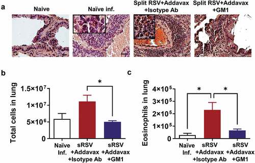 Figure 4. Lower eosinophil infiltration in NK depleted sRSV+Addavax immunized mice. (A) Eosinophils stained in the lung tissues. The lung tissues were collected from mice (n = 5) at day 5 post-RSV infection and stained with hematoxylin and Congo red (H&CR). Scale bars represent 100 μm (×100 magniﬁcation). The insets indicate infiltrated eosinophils (x400 magnification). (B) Total cell numbers of the RSV-infected lungs were counted and calculated by trypan blue staining under a microscope. (C) The number of eosinophil in lung. Eosinophil population (CD11b+SiglecF+) was determined by flow cytometry and the number was calculated by multiplying the eosinophil percentages with the total cell numbers. One-way ANOVA and Tukey’s multiple comparison tests were performed. *; p < .0332