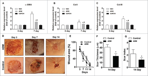 Figure 4. Porcine ADM treatment accelerated wound closure and reduced scar formation in vivo. (A) α-SMA expression in wound tissue at day 7. (B) Collagen-I expression in wound tissue at day 7. (C) Collagen-III expression in wound tissue at day 7. (D) Representative wound images. Images were taken after carefully removed porcine ADM. (E) Wound area (%) over time. (F) Scar thickness. (G) Scar index. N = 10 mice/group. (A, B, C) *P < 0.05 compared with day 0, #P < 0.05 compared with VEH. (E, F, G) *P < 0.05 compared with control.