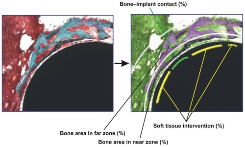 Figure 1 Description of histomorphometric analysis and parameters. Cross-sectional histological images were color converted to facilitate the discrimination of tissue types (from left to right images). To measure the bone area in the standardized vicinity levels from the implant surface, the tissue area was divided into two different zones: near (50 μm proximity) and far (50–200 μm) zones from the implant surface as segmented by white lines. The green lines represent the bone tissue in direct contact with the implant, while the yellow lines represent the bone tissue separated from the implant surface by soft tissue intervention. See the detailed description in the Materials and Methods section.