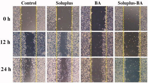Figure 8. Soluplus-BA micelles inhibit migration. MDA-MB-231 cells were seeded in 24-well plates and incubated at 37 °C. After the cells grew to 90% confluence, they were scratched with a 200 µl pipette tip. The cells were treated with Soluplus-BA or BA, and photographed at 0, 12, and 24 h, respectively.