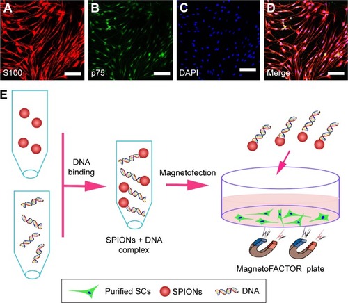 Figure 1 Characterization of SCs and schematic representation of magnetofection.Notes: Double immunofluorescent staining showed the expression of S100 (A) and p75 (B) with DAPI nuclear counterstaining (C). Merge file showed a purity of >96% SCs (D). Schematic of cell magnetofection (E). Scale bars: (A–D) 100 μm.Abbreviations: DAPI, 4′,6-diamidino-2-phenylindole; SCs, Schwann cells; SPIONs, superparamagnetic iron oxide nanoparticles.