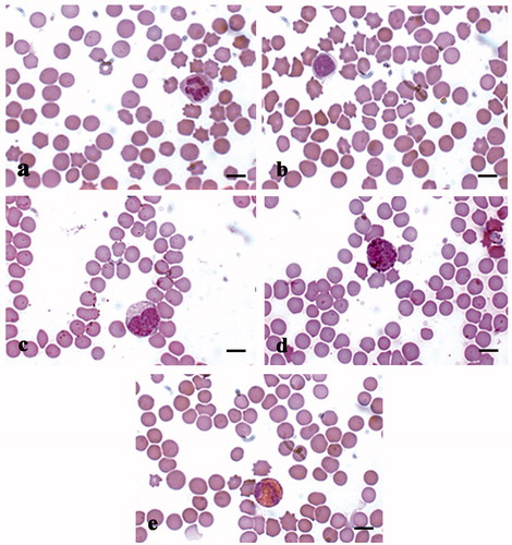 Figure 7. MGG-Quick rapid staining of leukocytes present in the peripheral blood smears: (a) neutrophilic granulocytes with lobed nucleus, (b) large lymphocyte, (c) monocyte, (d) basophilic granulocytes, and (e) eosinophilic granulocytes. Scale bars: 10 µm (a–e).
