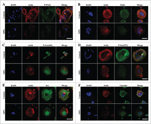 Figure 4. Effects of OPG on osteoclast morphology and distribution of Pyk2, Src and vinculin in OCs. Cells were plated and cultured on coverslips as described in the Methods. Cells treated with 40 ng/mL OPG for 24 h (lower images), or untreated (upper images), were fixed and stained for DAPI, F-actin and either p-Pyk2 402, Pyk2, p-Src(416), p-Src(527), Src or vinculin and examined by confocal immunofluorescence microscopy. (B, E, F) In untreated OCs, Pyk2, Src and vinculin were enriched in the peripheral actin-rich ring. Treatment with OPG for 24 h disrupted the peripheral actin ring and induced the redistribution of all 3 proteins to a more diffuse pattern throughout the cell interior. (A, C, D) OPG-induced signaling modulated Pyk2 and Src tyrosine phosphorylation states, causing a decrease in Tyr 402 Pyk2 and Tyr 527 Src labeling and an increase in Tyr 416 Src labeling at peripheral and central regions. OPG disrupted their co-localization with podosome in both regions. Scale bar = 20 μm.