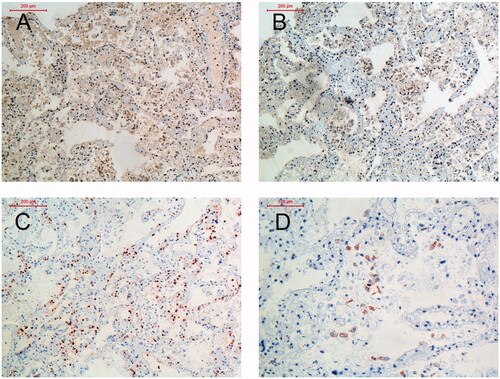 Figure 1. Presence of PUUV and inflammatory cells in the peripheral lung of a fatal case of PUUV infection. (A) PUUV nucleocapsid protein detected by polyclonal antibody. (B) Control, staining with isotype antibody for unspecific binding. (C) Neutrophils staining for elastase. (D) CD68 positive cells. Biopsies were embedded in glycol methacrylate (GMA) and used for immunohistochemistry staining. Photos are taken at ×10 (A–C) and ×20 (D) magnification and scale bars represents 200 µm and 100 µm, respectively. For details on antibodies see Supplementary table 4.