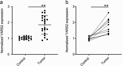 Figure 1. YARS2 was overexpressed in CRC tissues. (a) Overexpression of YARS2 mRNA in CRC tissues than normal tissues by RT-PCR analysis from local database in authors’ institute. (b) Detection of YARS2 mRNA expression in CRC tissues and adjacent non-tumor tissues collected from 10 patients with stage III colorectal adenocarcinoma. The expression levels of YARS2 were normalized to those of β-actin (**, P < .01), n = 10.