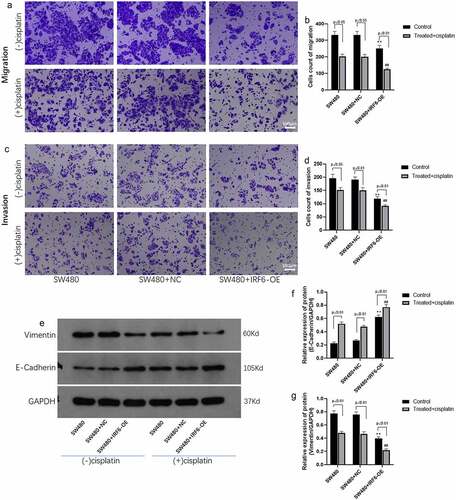 Figure 5. Migration and invasion and EMT-related proteins expression in CRC cells were measured. (a) Cell migration of SW480 transfected with NC or IRF6-OE plasmids was measured using Transwell. (b) Cell number of migrated cells was analyzed using ImageJ. (c) Cell invasion of SW480 transfected with NC or IRF6-OE plasmids was measured using Transwell. (d) Cell number of invasive cells was analyzed using ImageJ. (e) The protein expression of EMT-related proteins such as E-cadherin and Vimentin was detected using western blotting. (f) The relative protein expression of E-cadherin was analyzed by gray using ImageJ. (g) The relative protein expression of Vimentin was analyzed by gray using ImageJ. ** p < 0.01 vs SW480-NC in control cells without treatment. ## p < 0.01 vs SW480-NC treated with cisplatin. n = 3.