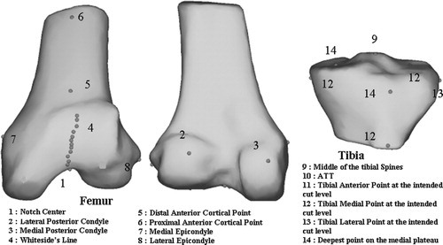 Figure 1. Location on a distal femur and proximal tibia statistical 3D model of the most commonly used landmarks in TKA.
