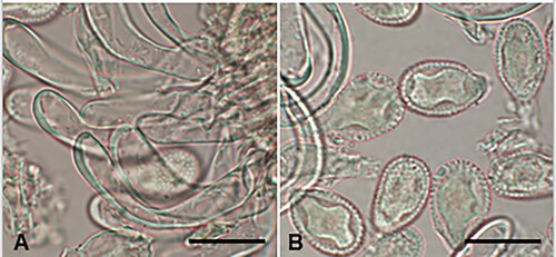 Figure 26. Pucciniastrum healyi on Fuchsia magellanica: A, Uredinial paraphyses. B, Urediniospores. Scale bars = 20 μm.