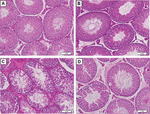 Figure 4. Histopathological changes by hematoxylin and eosin (H and E) in the testis of all experimental groups (200X). (A) Taken from a control rat. (B) Taken from a control rats treated with UAG. Both A&B showed normal testicular architecture characterized by well-preserved seminiferous tubule structures with a preserved definite membrane with a small lumen filled with mature sperm. Spermatogonia, primary spermatocytes, early spermatids, late spermatids, Sertoli and Leydig cells were also present and well preserved. (C) Taken from a HFD fed obese rat and showing degeneration and shrinked seminiferous tubules with wide lumens some of which are empty of mature sperm whereas the others have reduced sperm. Loss of spermatogonial cells, presence of giant and welled primary spermatocytes, loss of Sertoli and Leydig cells and intestinal edema were also present. (D) Taken from a HFD+ UAG treated rat showing improvements in the structure of seminiferous tubules and size, regeneration of Sertoli and Leydig cells, and absence of edema. All stages of spermatogonial cells with central sperms in the lumen of tubules were seen.