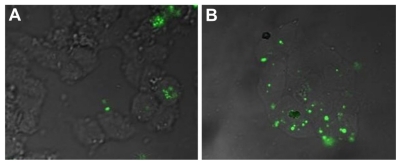 Figure 8 Confocal laser scanning microscopy images of KB cells after a 6 hour incubation period at 37°C with nontargeted nanoparticles-(fluorescein isothiocyanate) (NPs[FITC]) (A) and targeted NPs(FITC)-polyethylene glycol-Folate (B) (magnification 400×).