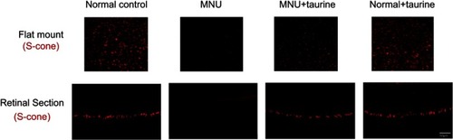Figure 7 In the retinal sections, M-opsin staining in the N-methyl-N-nitrosourea (MNU) group was undetectable. By contrast, the M-opsin staining was evident in the ONL of the MNU+taurine group. In the retinal flat mounts, the M-cone opsin positive cell counts in the MNU+taurine group were significantly larger than those in the MNU group. In the MNU+taurine group, the M-opsin positive cells were distributed throughout the retinal flat mount. Most of the M-opsin positive cells were located in the ST quadrants and the fewest cells in the IN quadrant, suggesting that M-cone photoreceptors from the ST quadrant benefited most from the taurine treatment.