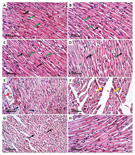 Figure 2 AV and ED prevent CP-induced cardiac injury in rats. Photomicrographs of the heart tissue sections of control (A) and rats treated with AV (B) and ED (C) showing normal structure of the cardiomyocytes with normal nuclei (green arrow) and cytoplasmic striation (black arrow), CP-intoxicated rats (D–F) showing degenerative changes (blue arrow), fragmented myofibrils (black arrow), nuclear pyknosis (yellow arrow), increased intercellular spaces between adjacent cardiomyocytes and many congested intermuscular blood vessels (red arrow), and CP-intoxicated rats treated with AV (G) and ED (H) showing improved histological architecture of the heart with fewer degenerative changes and congestions (arrow). (H&E, Scale bar = 50 µm).