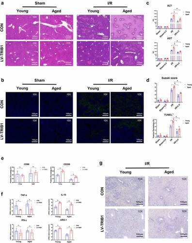 Figure 5. Restoration of TRIB1 induced macrophage anti-inflammatory M2 polarization to alleviate hepatic I/R injury. Lentiviral infection of macrophages was performed to overexpress TRIB1 following the manufacturer’s protocol. LV-infected BMDMs were infused back into the mice via the tail vein at 1 hr pre-operation. HE (a) and TUNEL-stained (b) tissue sections of livers. Average levels of serum ALT and AST in mice (c). Suzuki’s scores based on liver H&E-stained sections and TUNEL-positive percentages evaluated by ImageJ software (d). The macrophage polarization phenotype (CD86, CD206) (e) and inflammation-related gene expression (TNF-α, IFN-γ, IL-10, ARG-1) (f) were measured by qRT–PCR. CD206 detected by IHC in liver tissue sections post I/R (g). Data are presented as the mean ± SEM and performed by one-way analysis, P values <0.05 (two-tailed) were considered statistically significant.