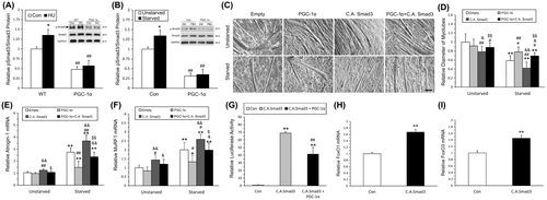 Fig. 6. PGC-1α repressed the phosphorylation of Smad3 in vivo and suppressed starvation induced C2C12 cells atrophy via the repression of pSmad3.
