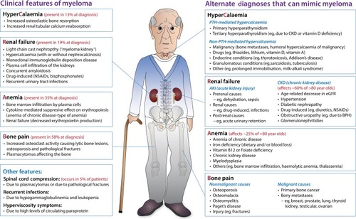Figure 2 Clinical features of myeloma and other diagnoses which may mimic myeloma.