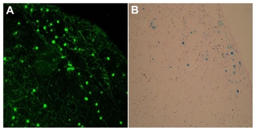 Figure 5 Morphology of superparamagnetic iron oxide-enhanced green fluorescent protein-labeled dendritic cells in draining lymph nodes after being stained with (A) immunohistochemistry and (B) Prussian blue staining (400×).