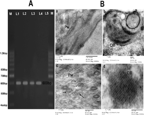 Figure 2. (A): Agarose gel electrophoresis analysis of amplified ZYMV- cp gene fragment Lanes (1– 5). RT-PCR products of five ZYMV samples showing amplified ZYMV-cp, Gene fragment of the correct size 600 bp (arrow) in lanes (1,2,3 and 4). Lane (5). Healthy watermelon. M: DNA ladder marker. (B): Ultrathin section of a Zucchini yellow mosaic virus-infected watermelon mesophyl cell. A,B,C,E and F: Showing laminated aggregate of crystalline particles (CP), pinwheel inclusions (pw), cristal inclusion bodies (CIB), scrolls and viral particles (VP), VP. = viral particles.