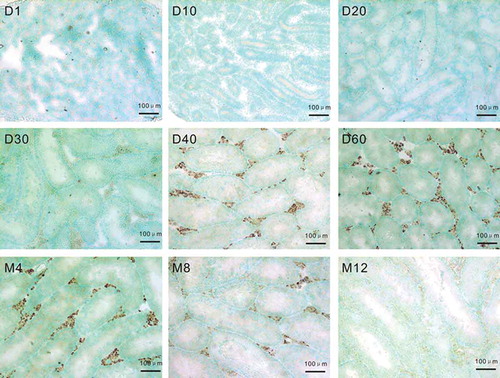 Figure 1. In situ hybridization (ISH) of Lipocalin-2 (LCN2) mRNA from CD-1 mice of different ages. Testes tissues were collected at different ages and assessed by ISH. The figure showed LCN2 was mainly expressed in Leydig cells. Day 1, 10, 20, and 30 testis had almost no ISH signals. Day 40 and 60, month 4 and 8 testis showed strong positive signals. And the signals were decreased in month 12 testis. D: days; M: months; Bar = 100 μm.