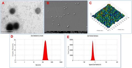 Figure 2 Characterization of PLGA nanoparticles. (A) TEM image of the BZK nanoparticles (×100,000), (B) Scanning electron microscopy (SEM) images of the BZK nanoparticles (×15,000), (C) AFM images of the BZK nanoparticles for horizontal and morphologic analysis (X and Y scale bar 1600 nm), (D) DLS particle size analysis of the BZK nanoparticles. (E) Zeta potential measurement of the BZK nanoparticles.