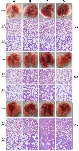 Figure 7 Photos and HE staining of lung tissue of the control group (A), phage group (B), bacteria-infected group (C) and phage rescued group (D) at 12 hpi; 24 hpi and 36 hpi.