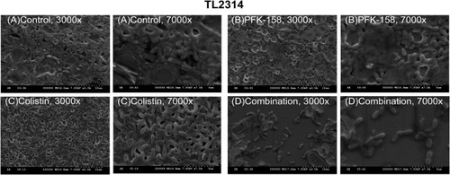 Figure 4 Images from SEM for colistin-resistant P. aeruginosa TL2314 exposed to different condition. (A) Control; (B) 16 μg/mL PFK-158 alone; (C) 2 μg/mL colistin alone; and (D) 2 μg/mL colistin and 16 μg/mL PFK-158 in combination.