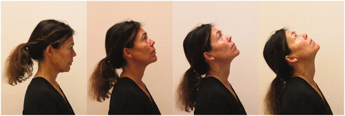 Figure 3. Photograph of the seated neck extension test. Illustrating start position (A) and the individual neck extension movement pattern (B–D).