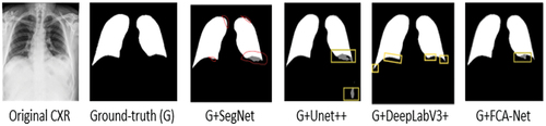 Figure 13. Example image overlap between segmentation results and Ground-truth of the four deep learning architectures being compared.