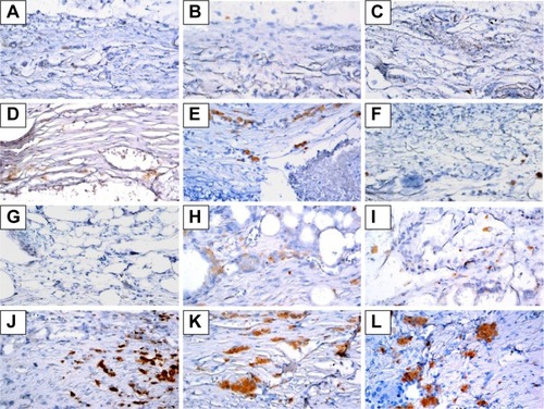 Figure 8 Immunohistochemistry analysis of bone morphogenetic protein-2 expression in calvarial defects at 8, 10, and 12 weeks after implantation of bone graft substitutes.Notes: Calvarial defects implanted without bone graft substitutes were used as controls. A–L show the higher magnification of the rectangle inset areas in Figure 7. Control group (A–C); CS group (D–F); CS/PLGA group (G–I); CS/SIM/PLGA group (J–L).