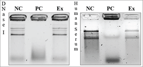 Figure 4. Effect of soluble DNase (left) or human serum (right) on pDNA encapsulated in L-cL liposomes. The agarose gel electrophoresis analysis of protective properties of L-cL liposomes toward encapsulated genetic drug (pDNA). NC – negative control (liposomes + 10% Triton X-100), PC – positive control (liposomes + 10% Triton X-100 + DNase I or 50% human serum), Ex – experimental sample (liposomes + DNase or 50% human serum-incubation 8 h + 10% Triton X-100).