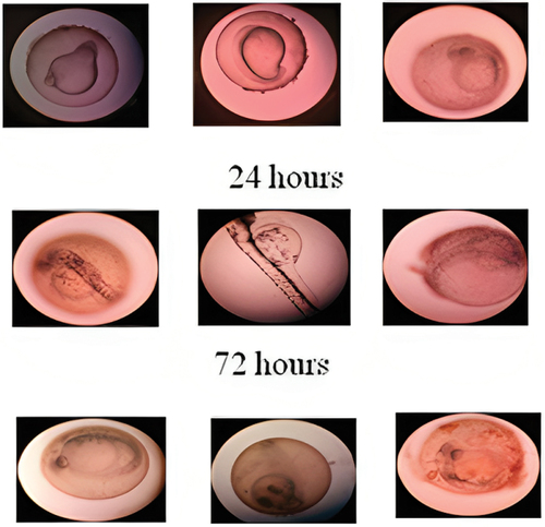 Figure 10. Zebra fish embryo – morphological change was noticed with high concentration of nanodrug.