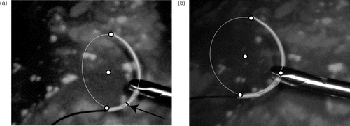 Figure 7. Cases providing additional reference points for the homography estimation. The additional points are (a) a colored ring on the needle and (b) a gripper-based marker.